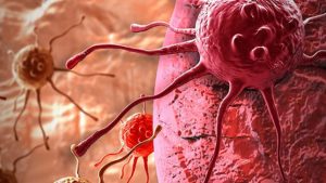 कैंसर से बचाव के लिए