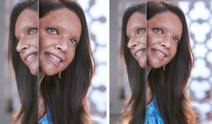 छपाक